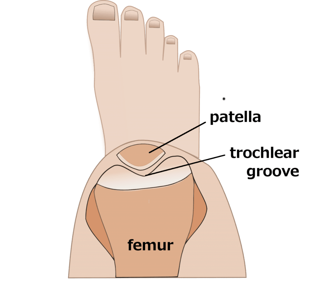 Kniecare tuberositas transpositie Nijmegen